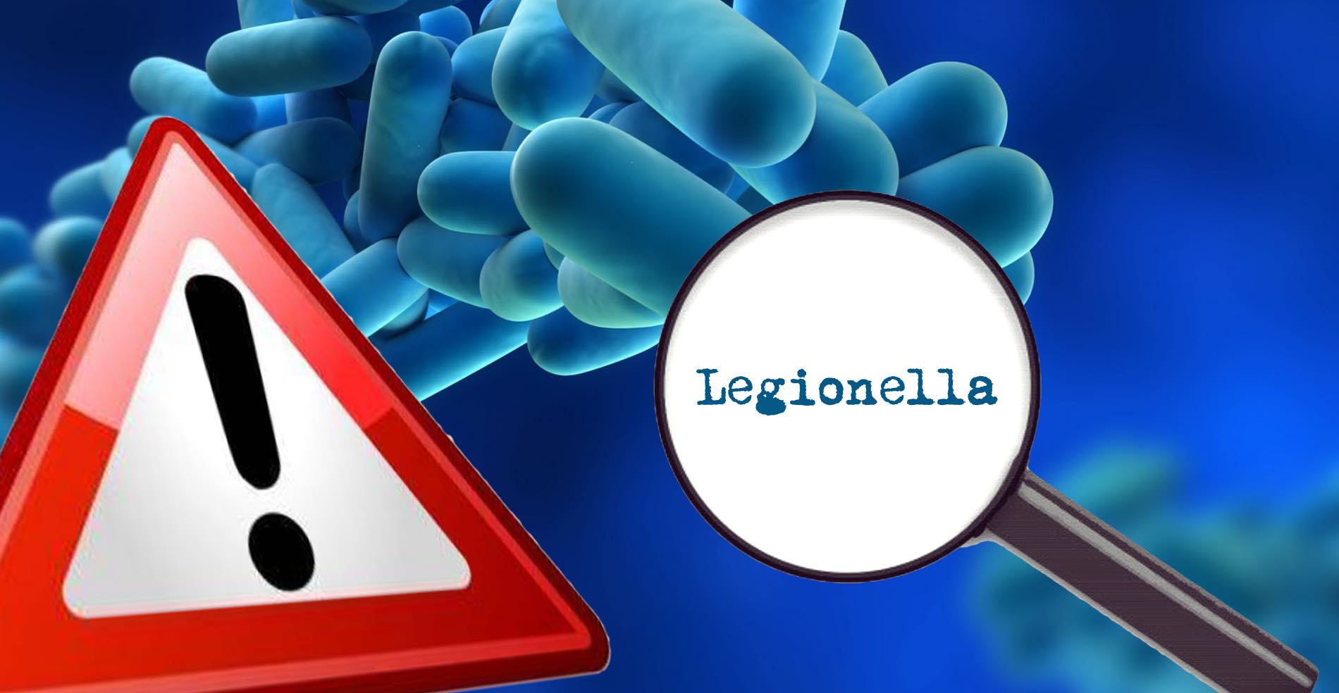 Quali sono i sintomi della Legionellosi?